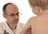 Повышенный и пониженный иммуноглобулин Е у детей в анализе крови: что это значит и какова норма?