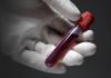 Как проходит подготовка к сдачи крови на биохимический анализ пациента?